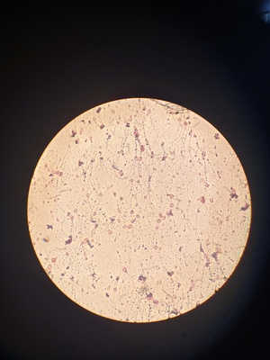 Red blood cells incubated with the extract
